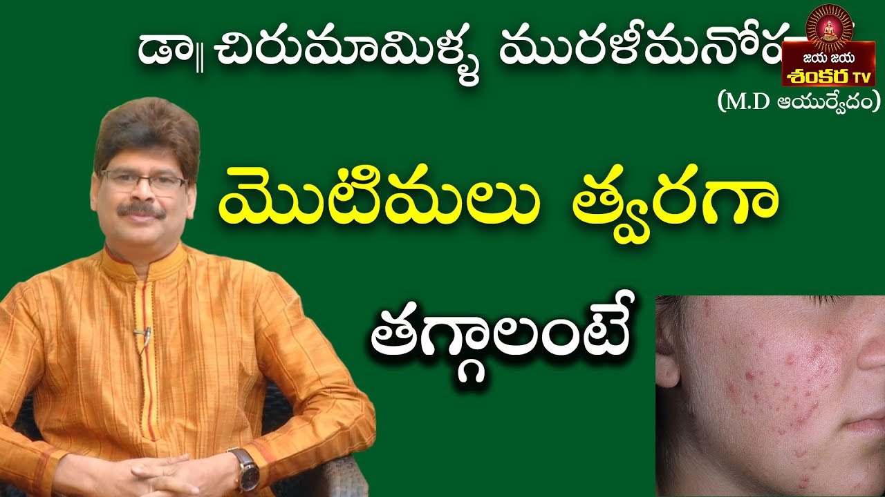 How to remove Pimples Overnight || Soundarya Vedam || Dr.Chirumamilla Murali Manohar ||