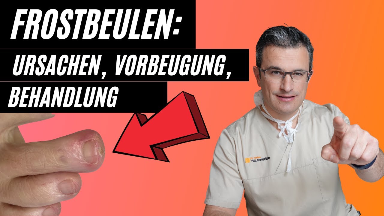 Frostbeulen (Perniones) an den Zehen: Bilder und Hausmittel #frostbeulen #perniones