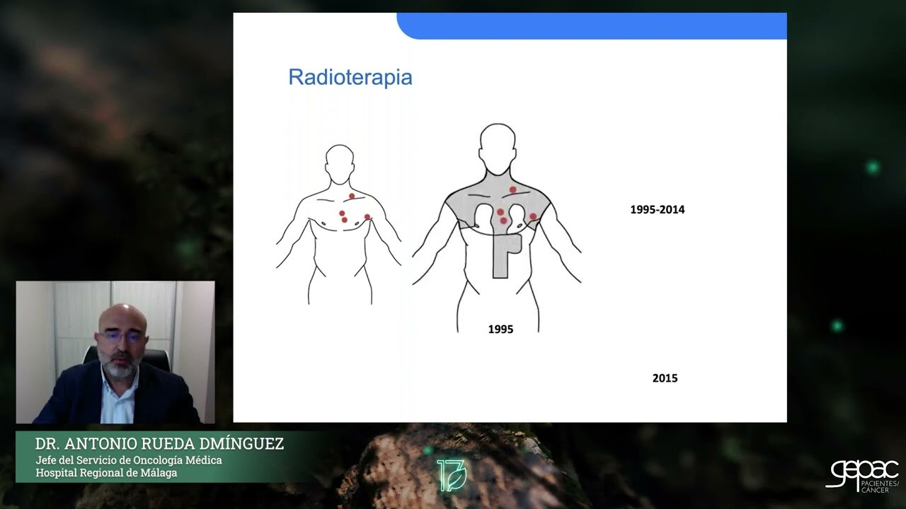 Linfoma de Hodgkin: diagnóstico y tratamiento - Dr. Antonio Rueda Domínguez