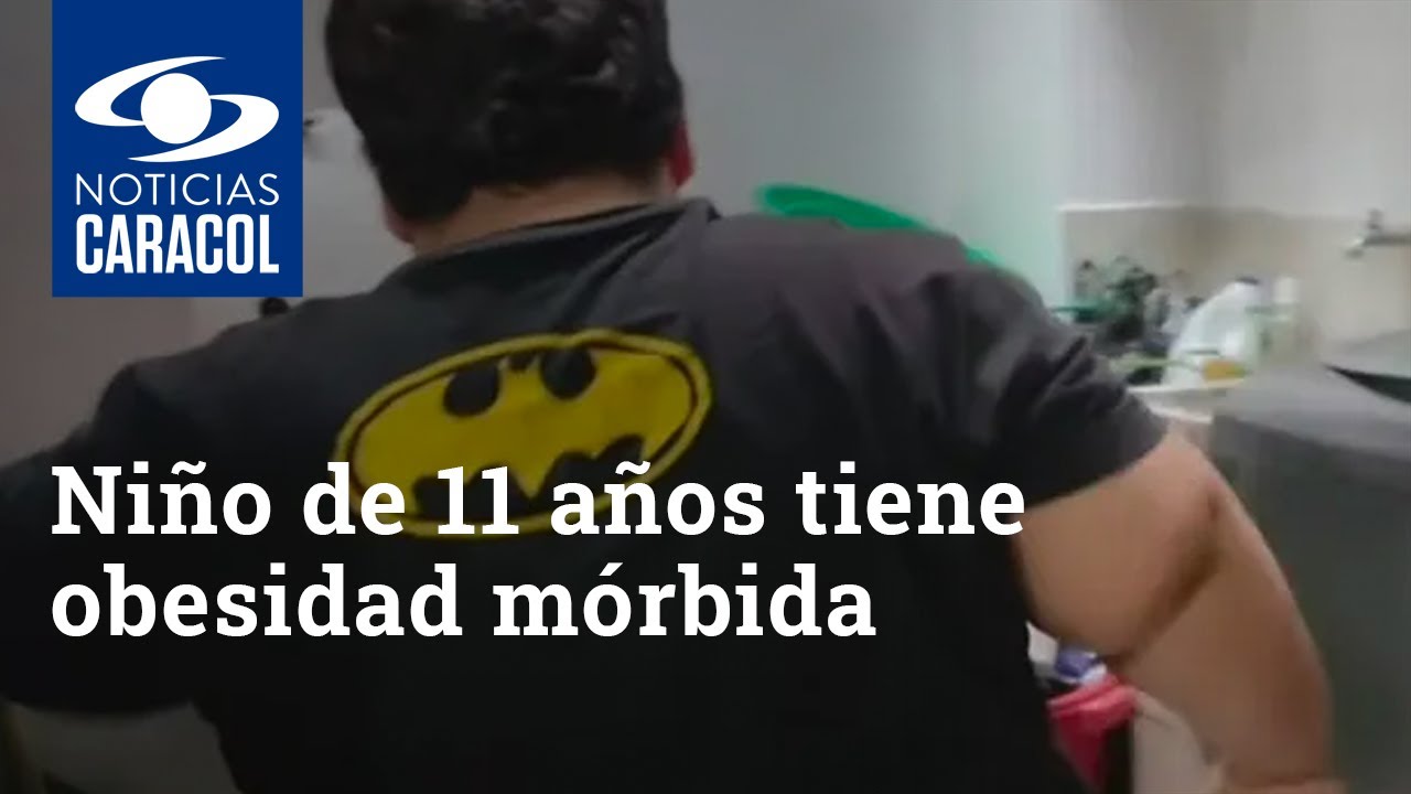 “Está en peligro de muerte”: madre de niño de 11 años que tiene obesidad mórbida