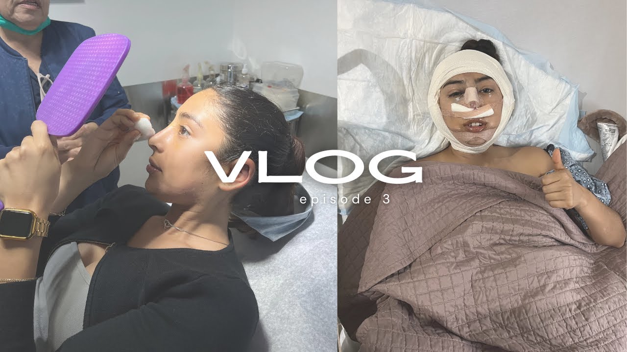 I Got Plastic Surgery! *Otoplasty, Mentoplasty, Rhinoplasty*