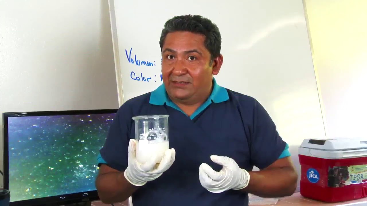 Espermograma. Evaluación de semen en Laboratorio