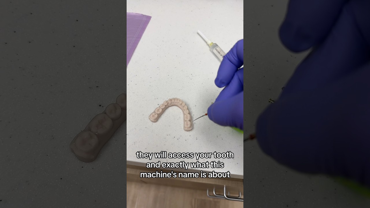 Gentlewave will make you have a whole different idea about root canal 💙🦷 #dentist #dentistry #root