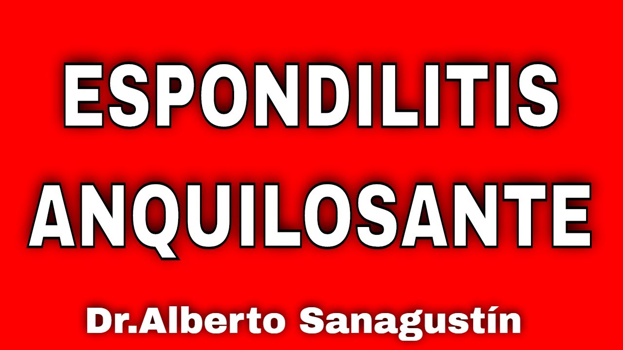 ESPONDILITIS ANQUILOSANTE (qu&eacute; es, s&iacute;ntomas y tratamiento)