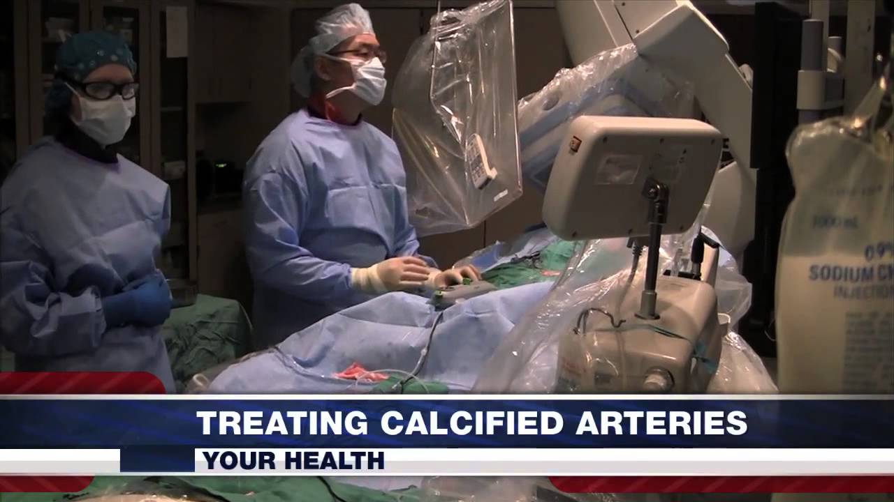 Calcified Artery Treatment, Dr. Arthur Lee, Dec 18, 2013, WCJB TV20 News