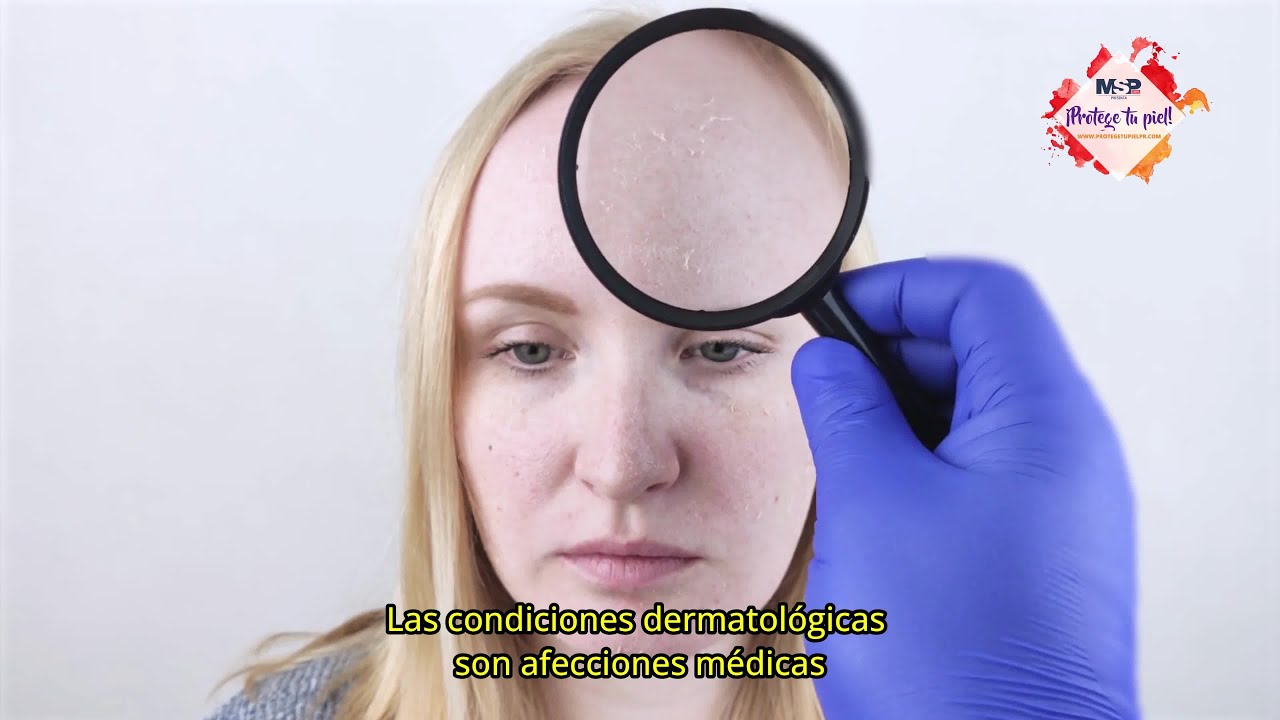 Las 3 de enfermedades de la piel que más afectan a las personas actualmente - #EspecialMSP