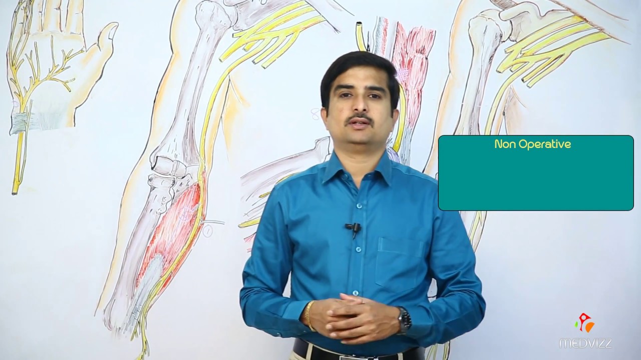 CUBITAL TUNNEL SYNDROME -  Ulnar neuropathy USMLE step 1 lecture , clinical anatomy
