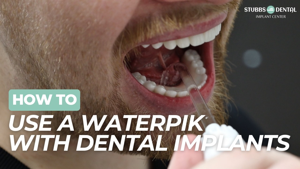 How to Clean All-On-X Dental Implants With a Waterpik