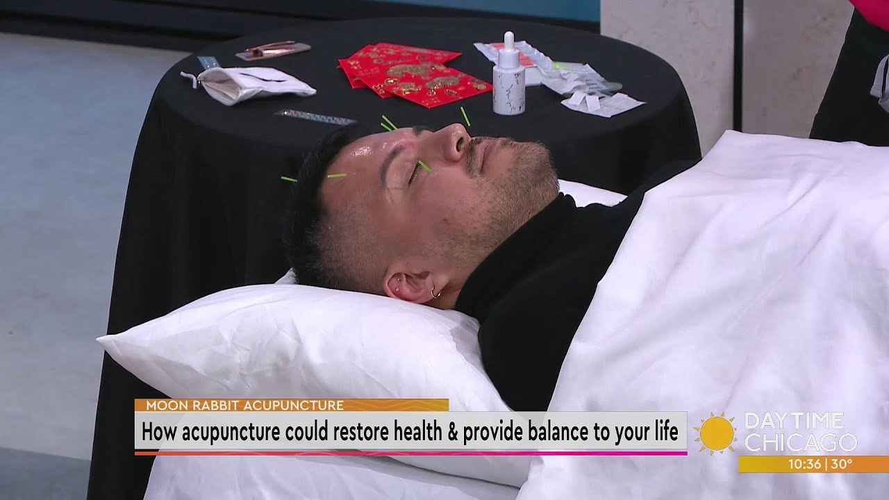 How acupuncture could restore health & provide balance to your life
