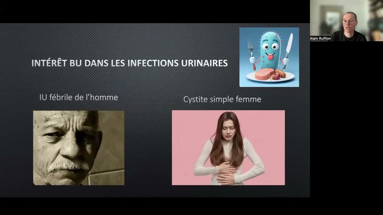 161 2 10 mn pour comprendre le bon usage de la bandelette urinaire en urologie