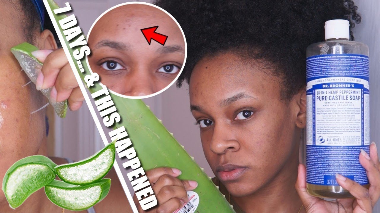 I USED FRESH ALOE VERA & PURE CASTILE SOAP ON MY FACE FOR 7 DAYS... & THIS HAPPENED!