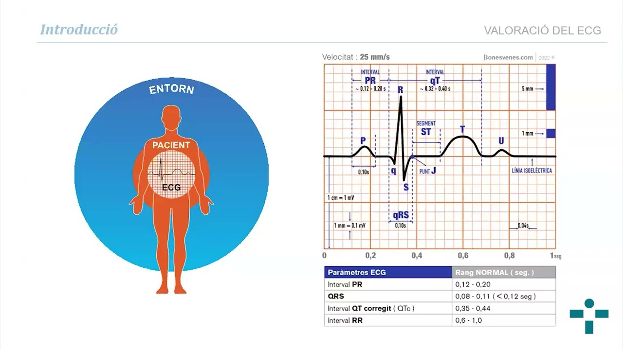 Webinar d'Urgències i Emergències Prehospitalàries: Patologia cardiològica a l'ECG en emergències