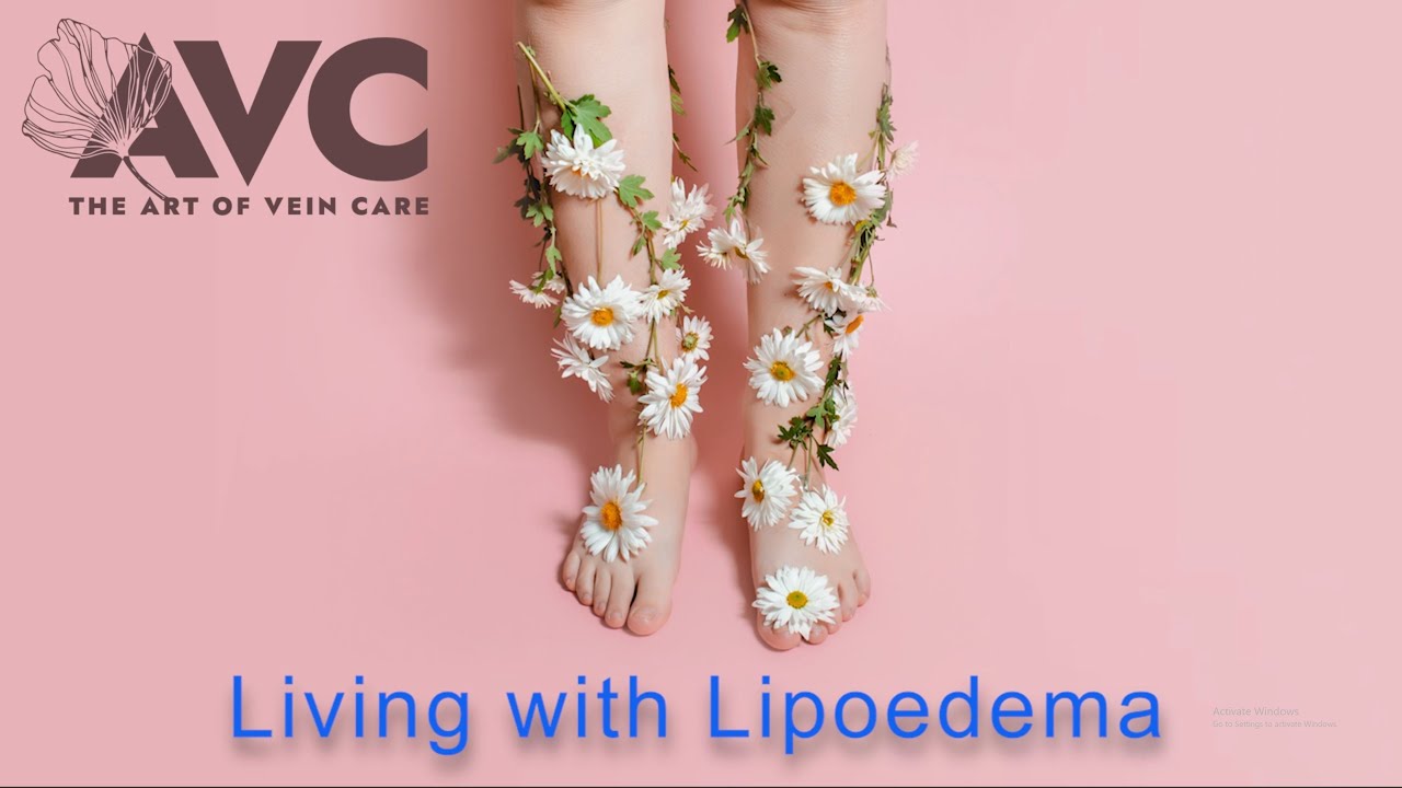 Living with Lipoedema