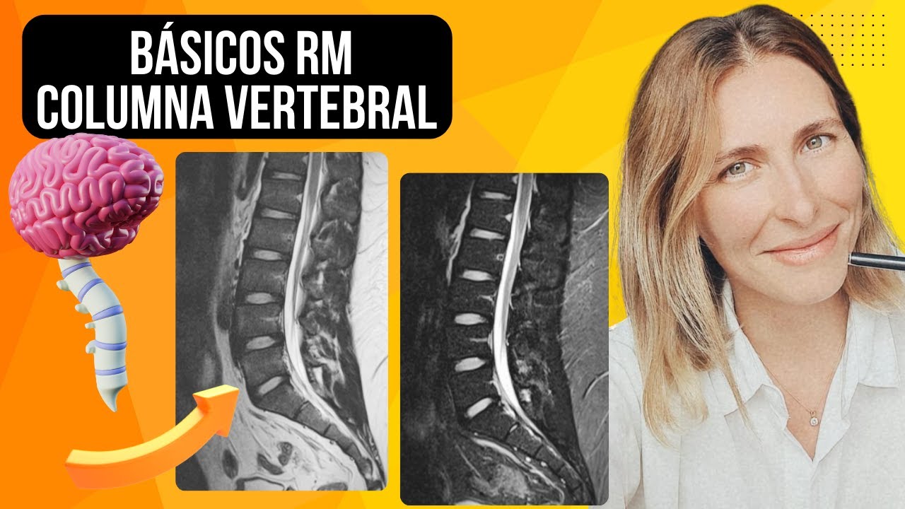 Resonancia Magnética de Columna: Guía Rápida para Principiantes