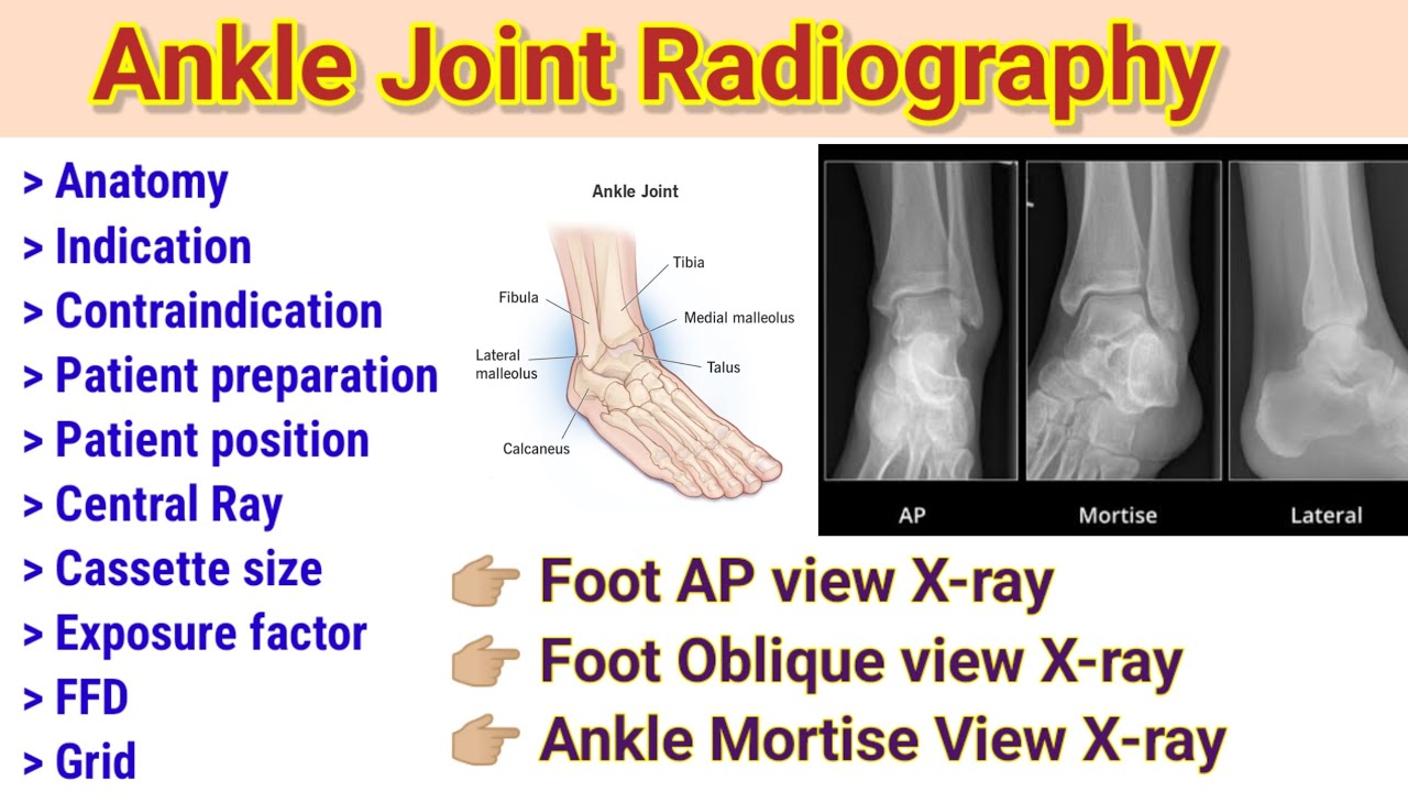 Foot Radiography # AP view # Lateral view # Mortise view x-ray # oblique view x-ray # By BL kumawat