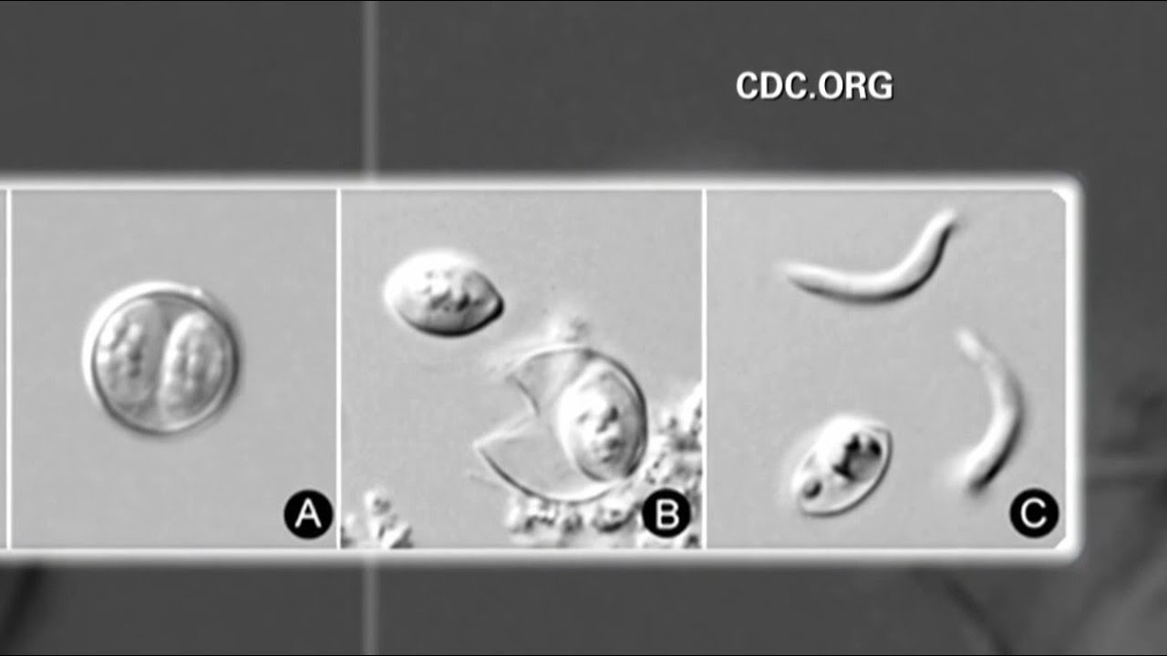 What you need to know about Cyclospora