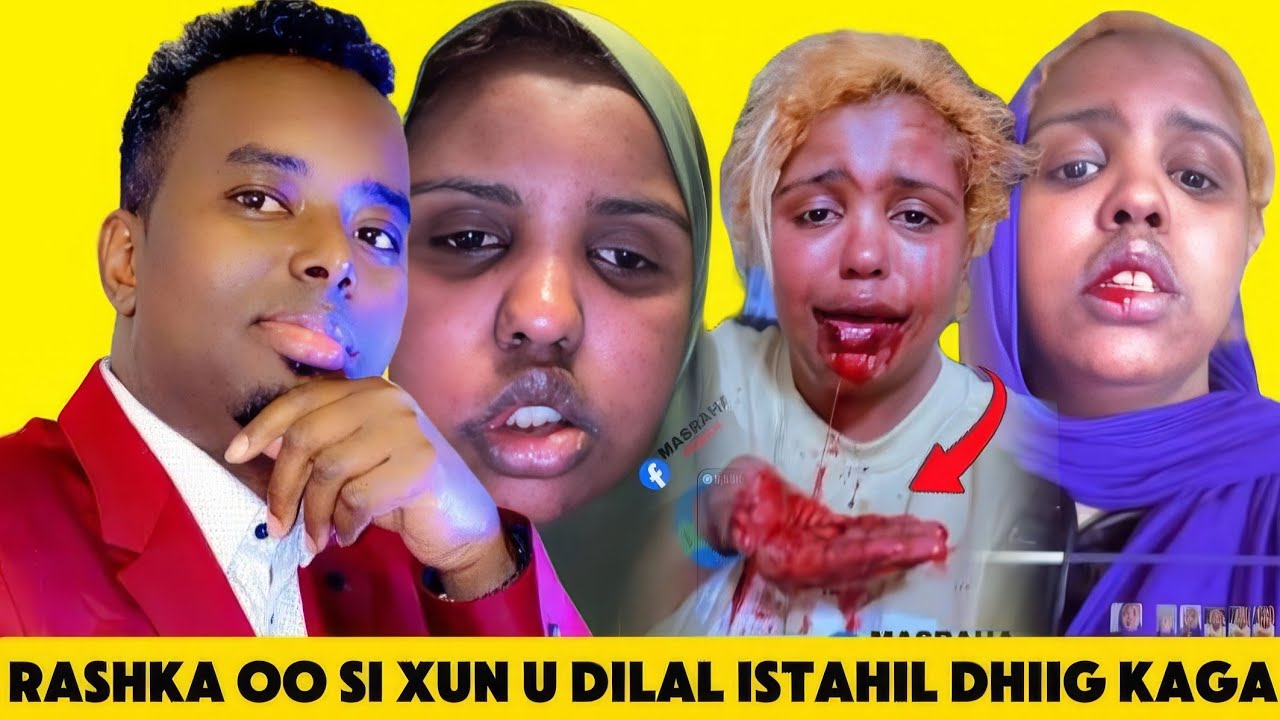 DAAWO RASHKA OO SI XUN U DILAY ISTAHIL ILKAHANA KA DAADIYAY