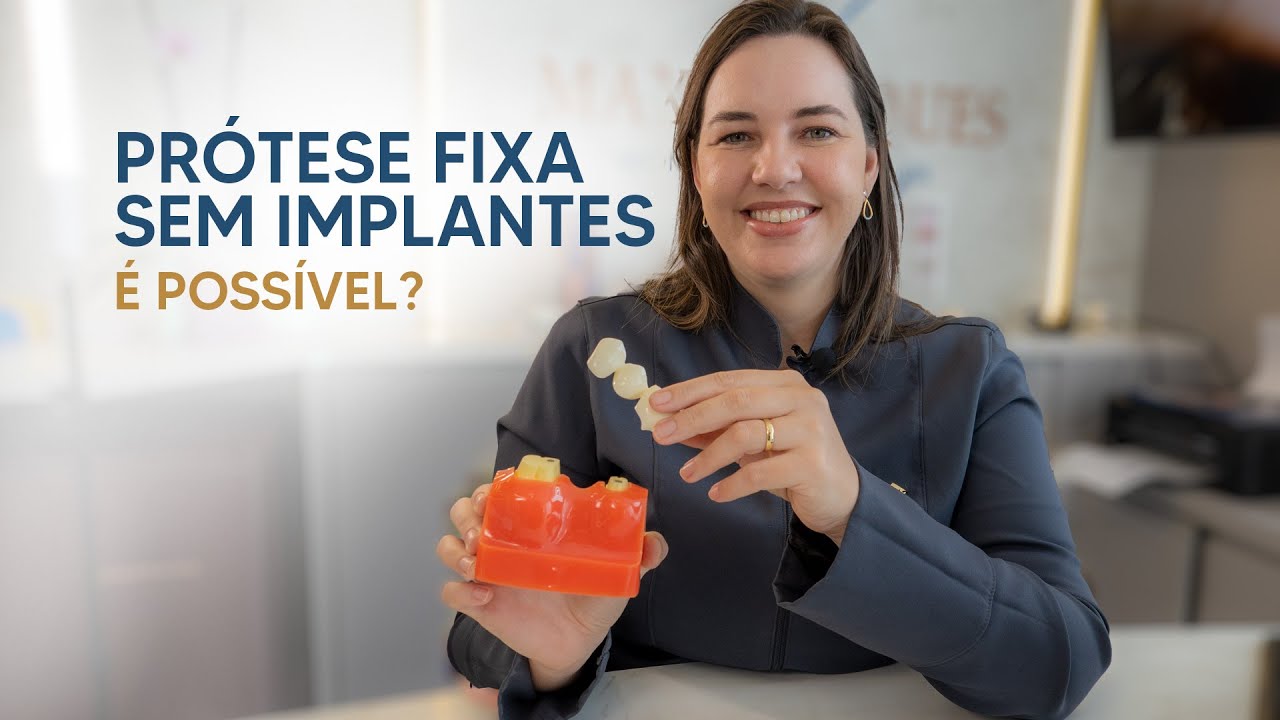 Pr&oacute;tese fixa sem implantes