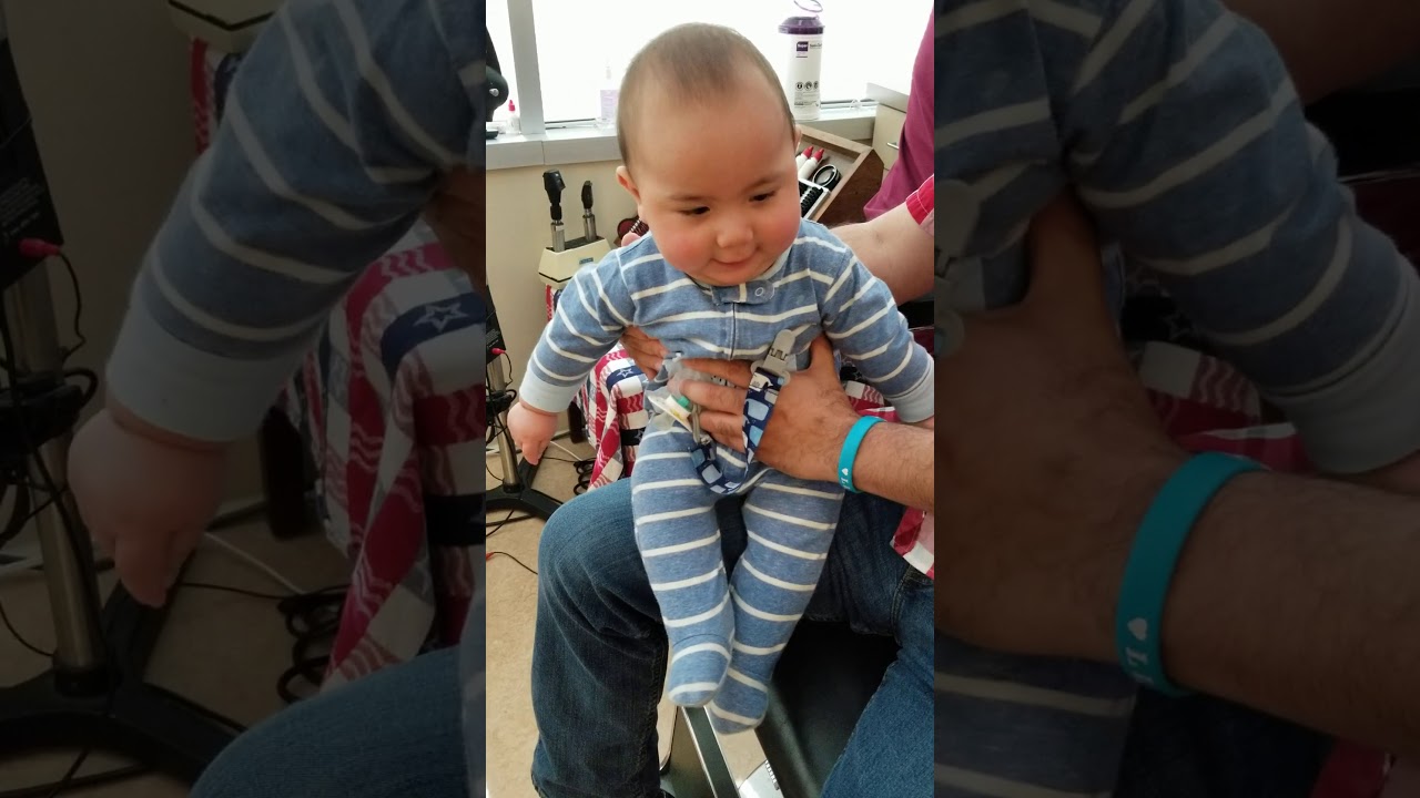 Shudder Attacks, Shudder Spells, Mimics Infant Seizures, Baby Shakes and Stiffens.