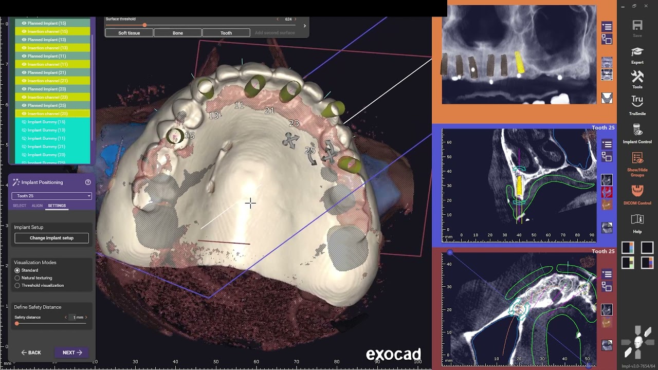Exoplan Case Demonstration 2