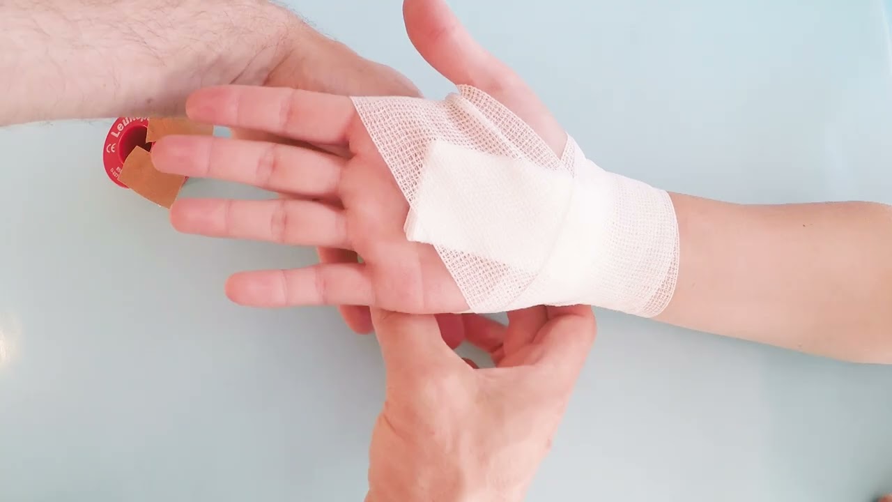 Verband Hand Karpaltunnel