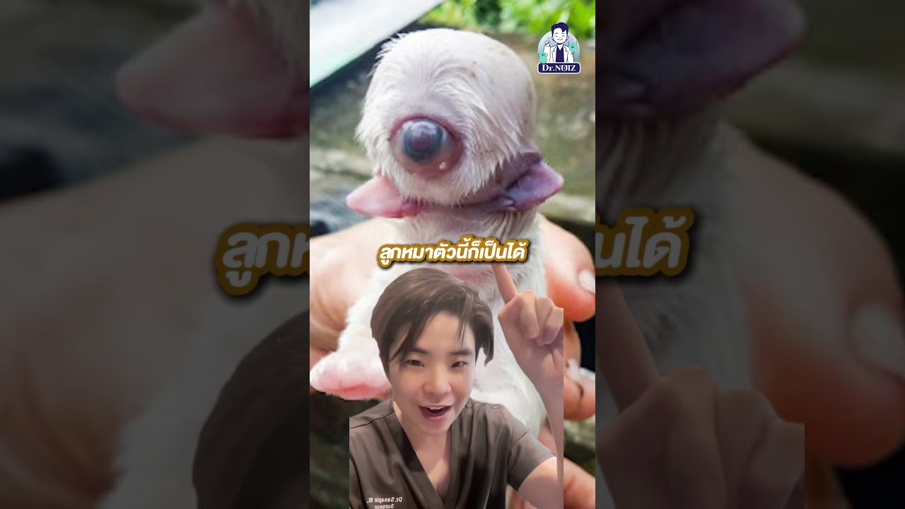 ไซคลอปยักษ์ตาเดียวมีจริง!! #หมอนุ้ย #หมอผ่าตัด #รักสุขภาพ #ยักษ์ตาเดียว