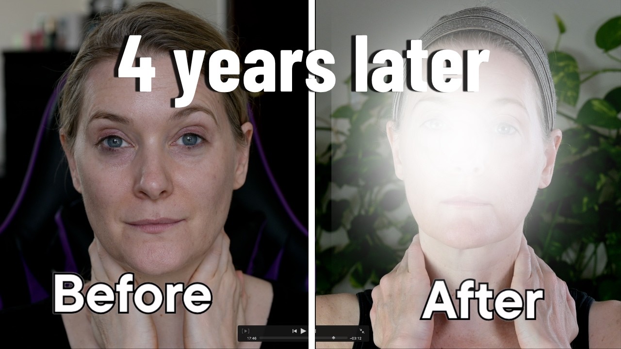 I Used Skincare Devices for 4 Years: Here's What I'd Actually Buy Again | Doctor Anne