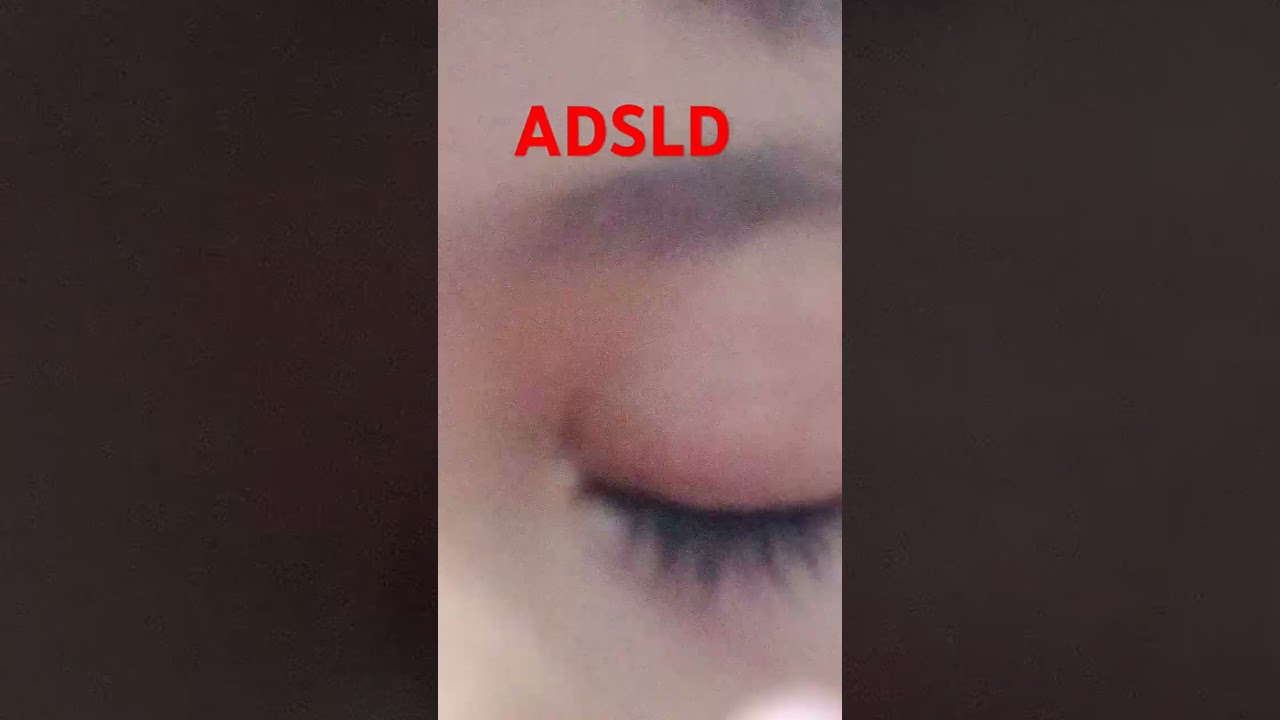 Ykdg