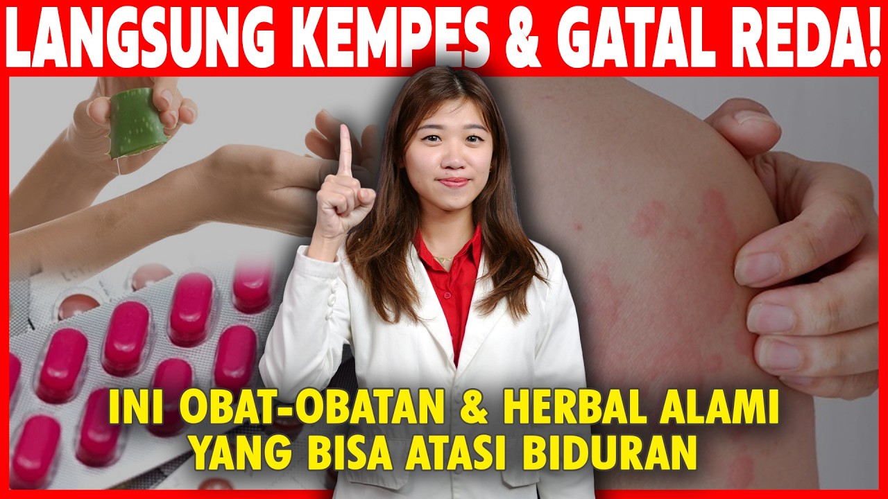 Kulit Merah Gatal-Gatal? Jangan Minum Obat! Sembuhkan Biduran dengan Cara Alami Ini