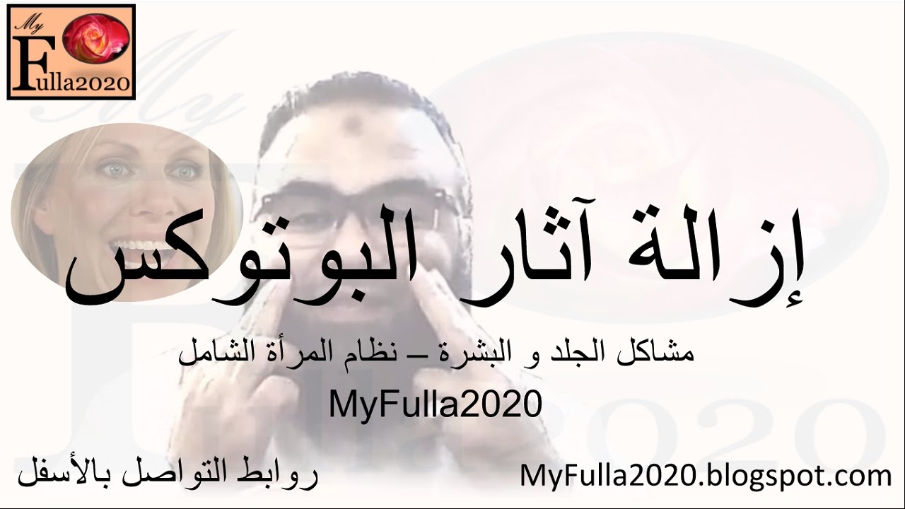 شرح إزالة أضرار البوتكس في #مسائل_التجميل_أبونورأحمدي | Speed up botox removal