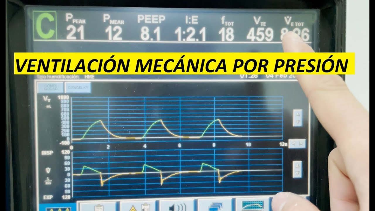 Ventilacion mecanica por presion