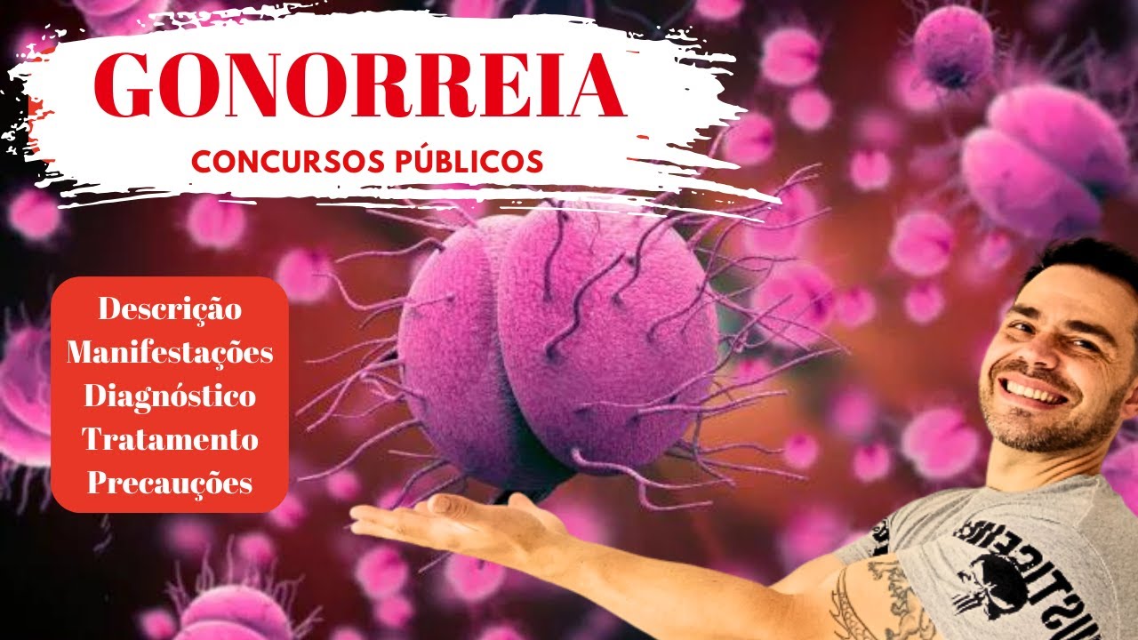 GONORREIA -  Sintomas, diagnóstico, tratamento e prevenção - Tudo para  CONCURSOS PÚBLICOS