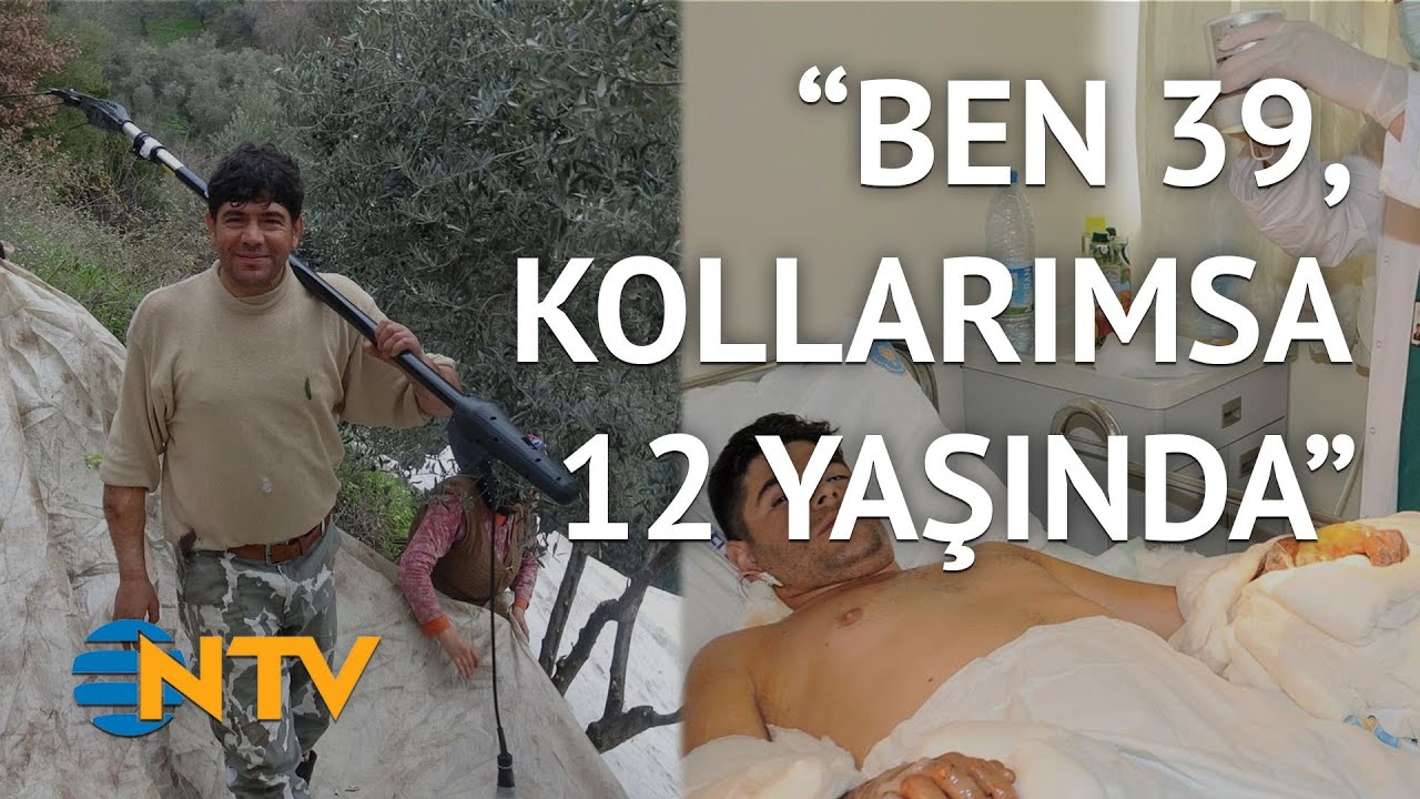 Türkiye’nin ilk çift kol nakilli hastası zeytin toplayıp çuval taşıyor