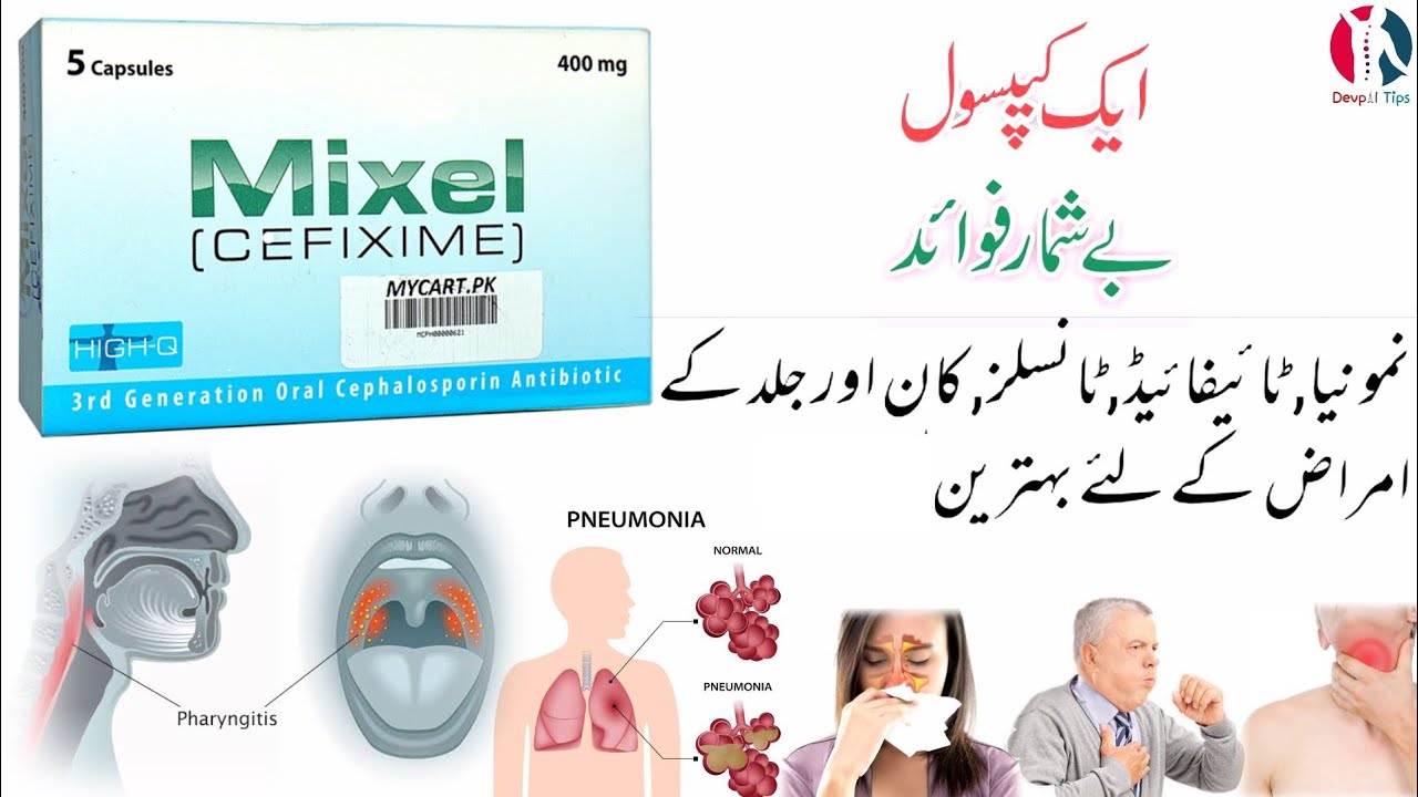 Mixel 400 mg capsule uses | Mixel cefixime uses in urdu | Cefixime uses in urdu and hindi