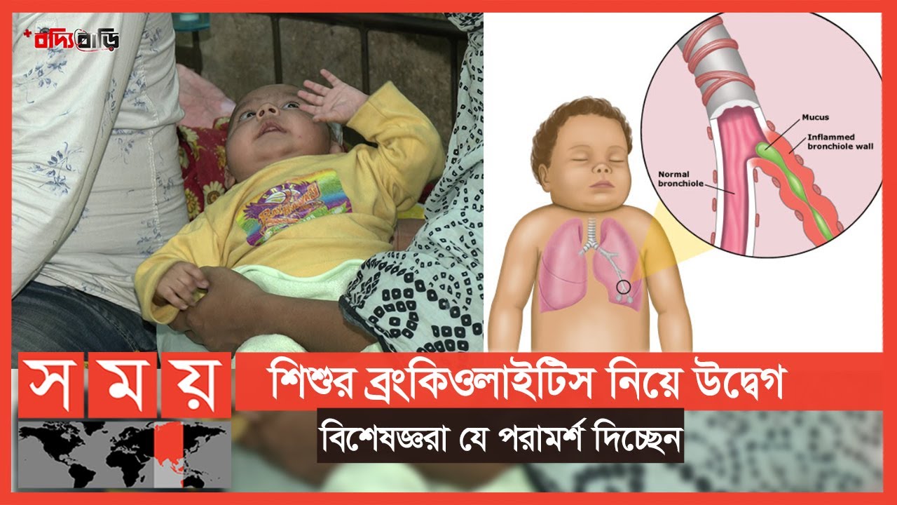 শিশুর ব্রংকিওলাইটিস, কারণ ও প্রতিকার | বদ্যি বাড়ি | Boddi Bari | Child Bronchitis