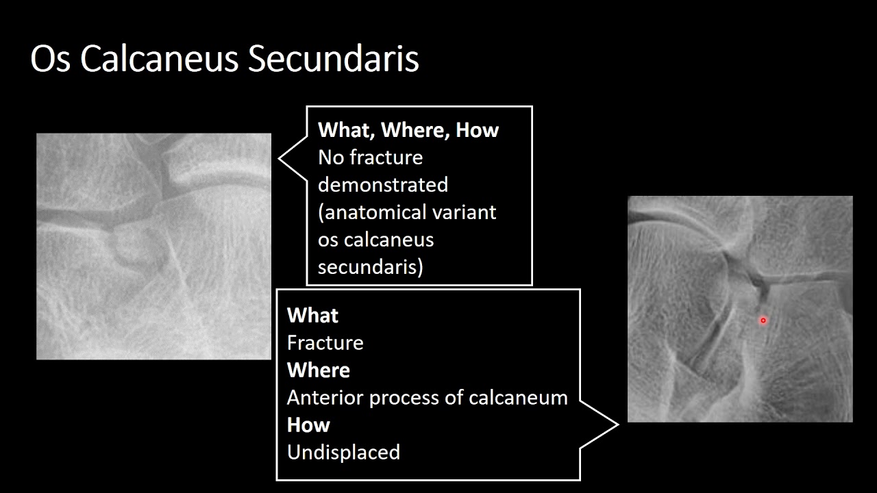 Анатомические варианты. Часть 1.
