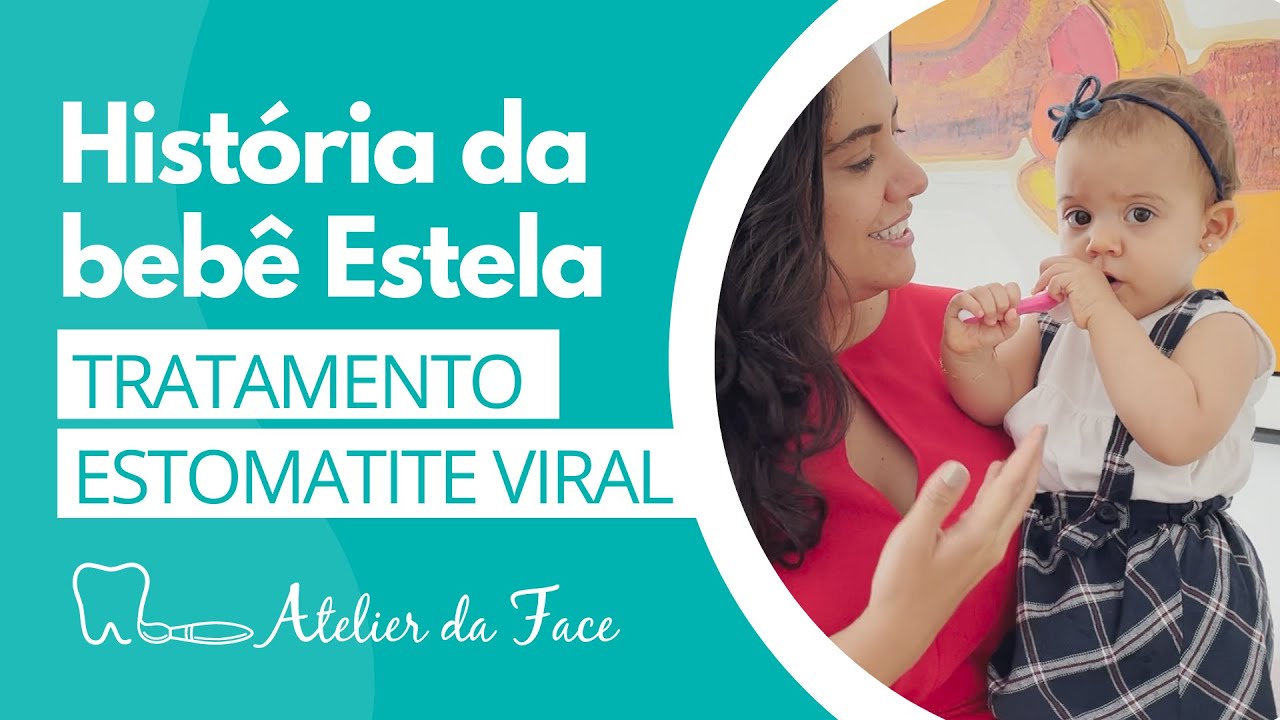 Aftas no bebê | Virose - Estomatite Viral | O que é e tratamento