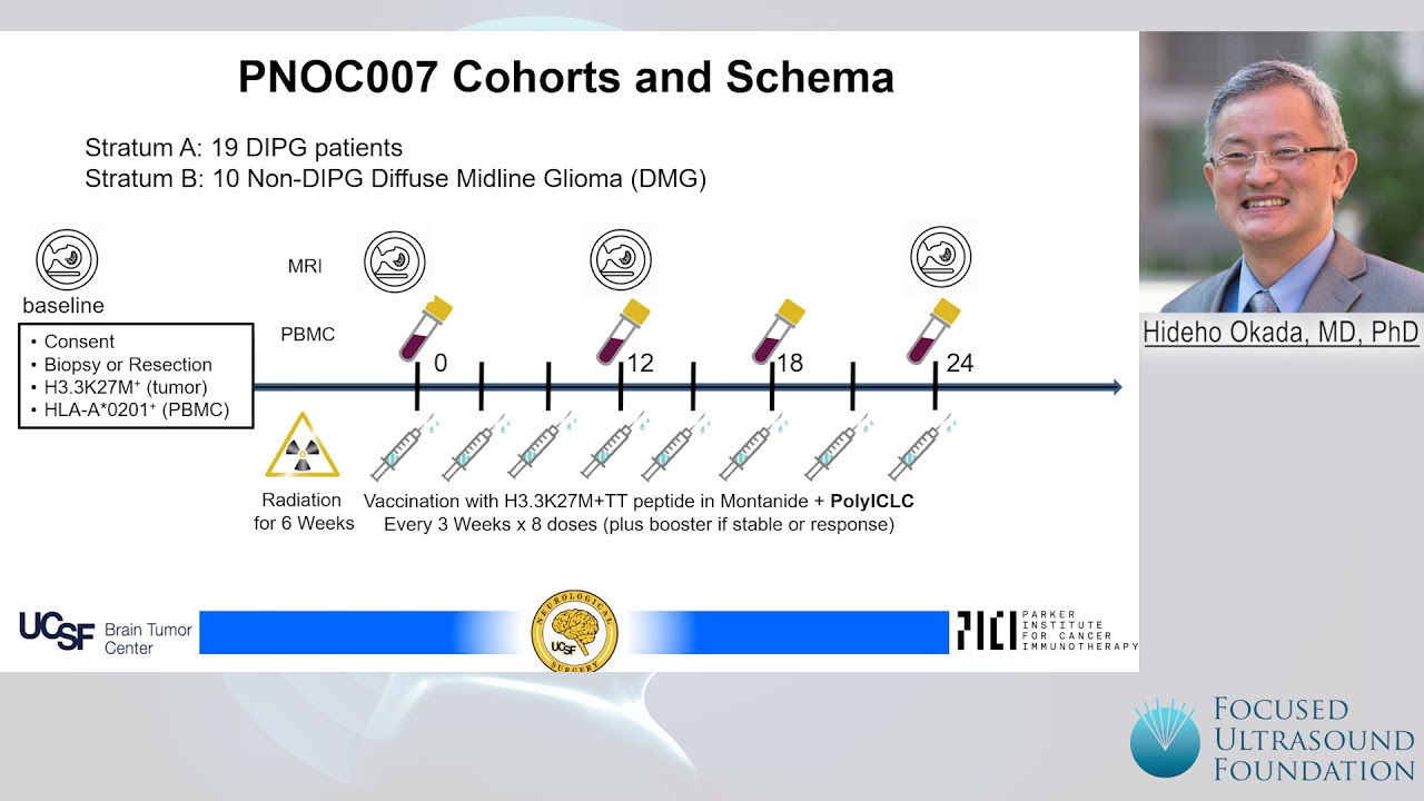 Hideho Okada - Immune Modulation and Immunotherapy for DMG DIPG
