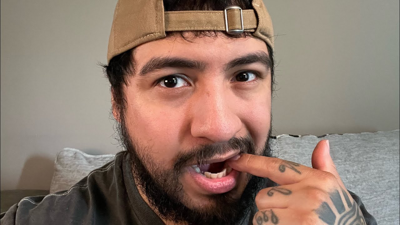 Intense ASMR Teeth Chomping 🍎 | Up-Close Mouth Sounds