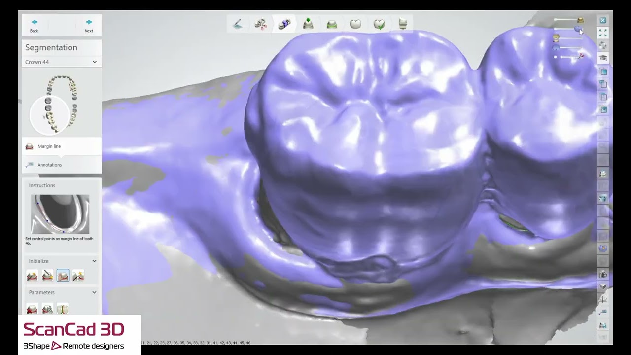 3shape 11-26-2026 K