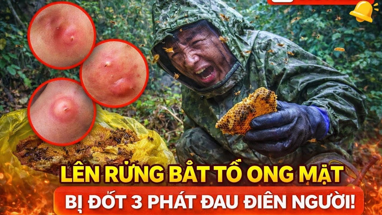 Sự Thật Đau Đớn – Lên Rừng Bắt Ong Mật Và Hậu Quả Bị Đốt 3 Lần