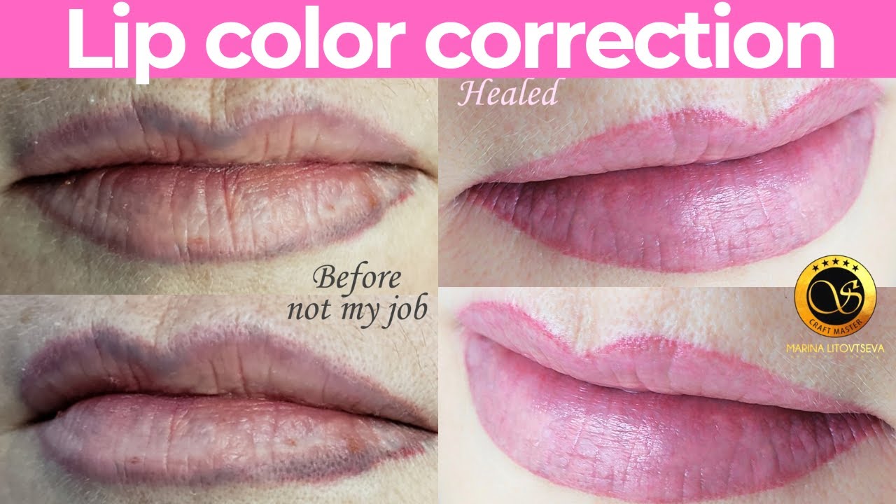 PMU Lip color correction. Laser lip tattoo removal