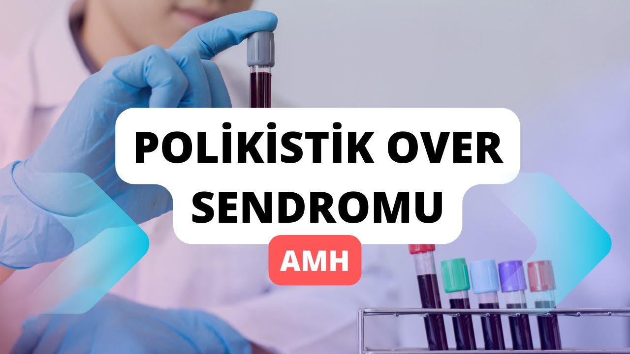 🔬 Polikistik Over Sendromu ve AMH: Bilimsel İnceleme ve Doğurganlık Üzerindeki Etkileri | 🎓🌸