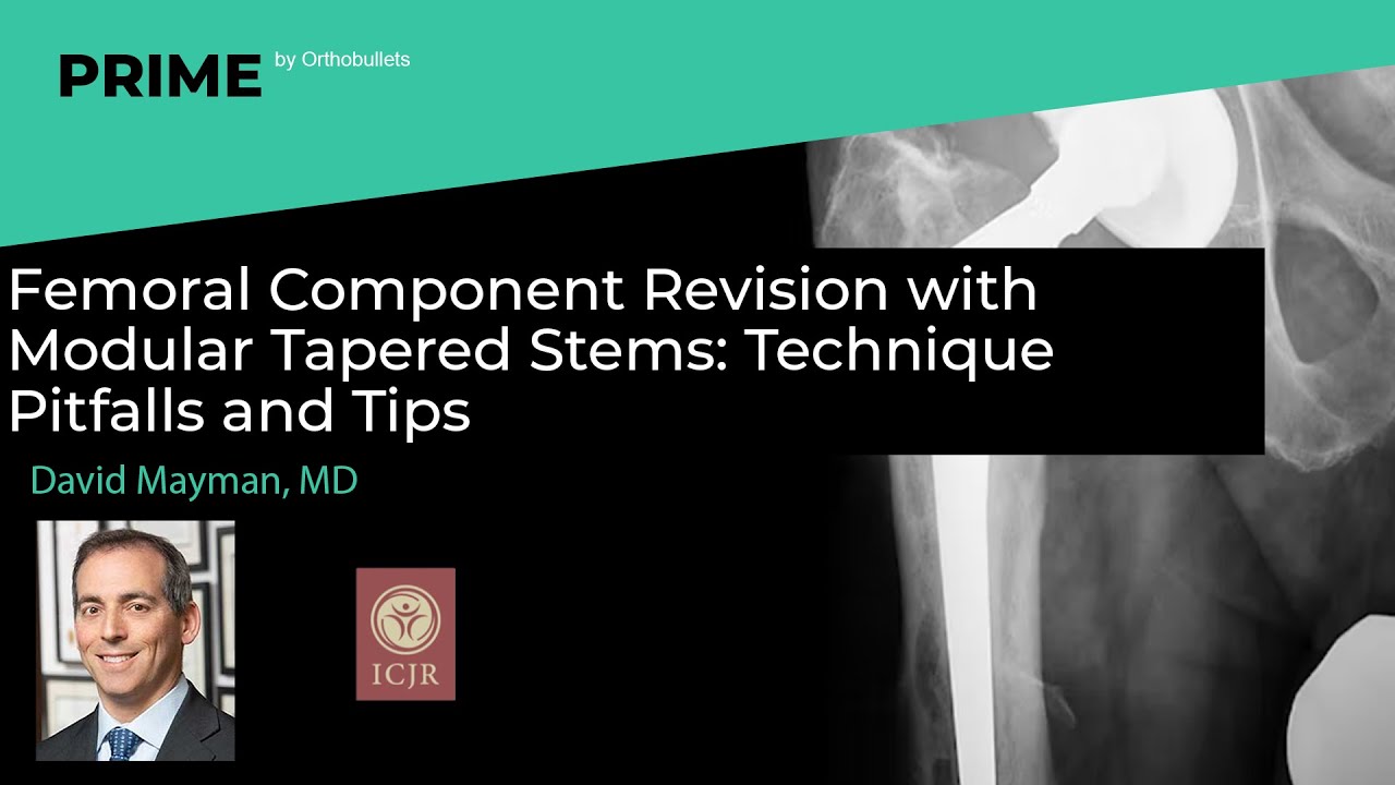 Femoral Component Revision with Modular Tapered Stems: Technique Pitfalls & Tips - David Mayman, MD