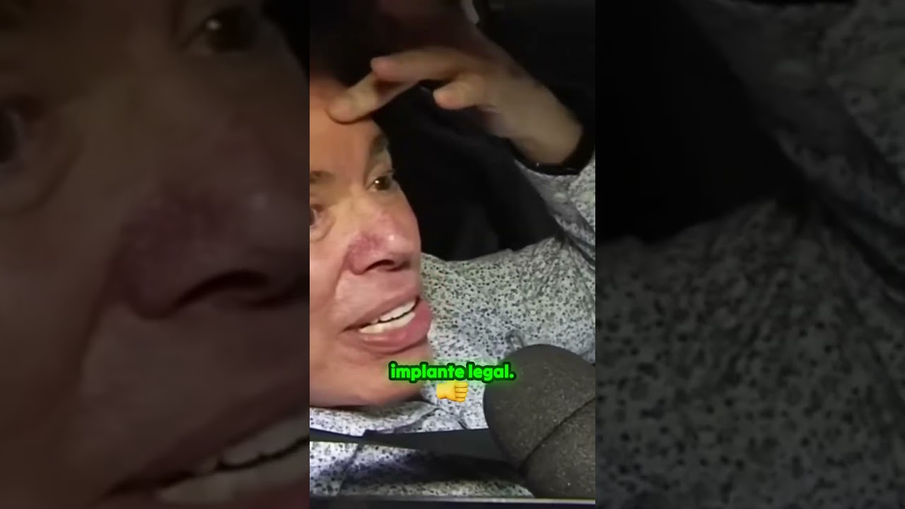 A verdade sobre o implante capilar do Rodrigo Faro! 😲✨