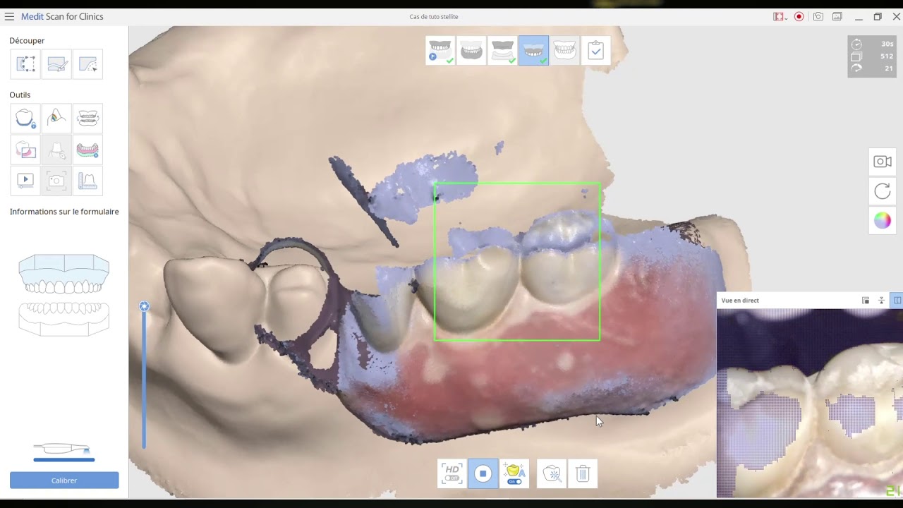 [I500] Tuto Scan et alignement d'un stellite Hors bouche.