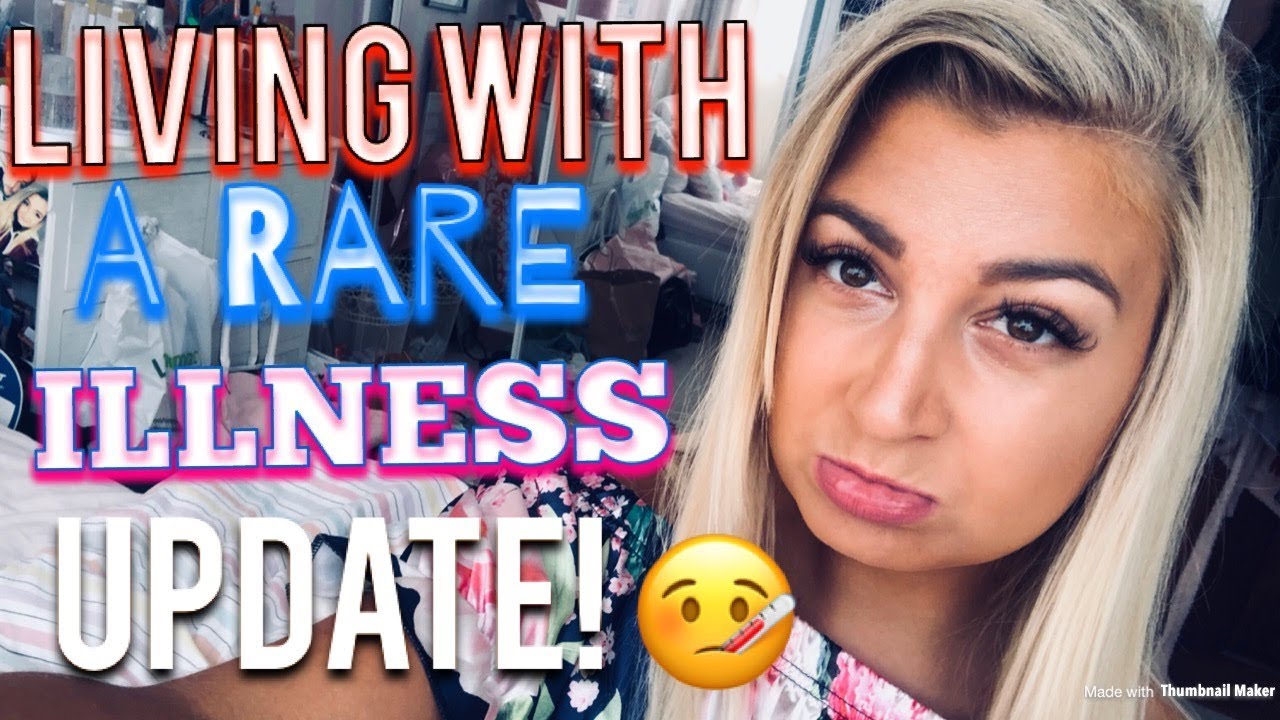 HOSPITAL UPDATE | BEHCETS DISEASE