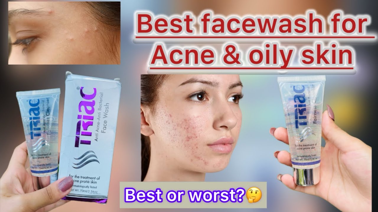 Which Facewash is Best for acne & oily skin?? || Triac facewash review|Vlogs With Ayesha
