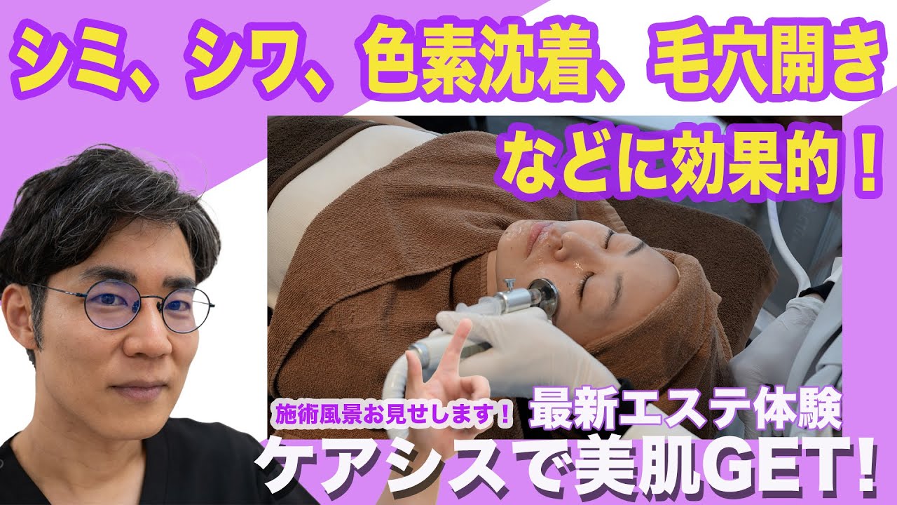 【シミ、シワ、色素沈着、毛穴の開きなどに効果的】ケアシスで美肌GET!