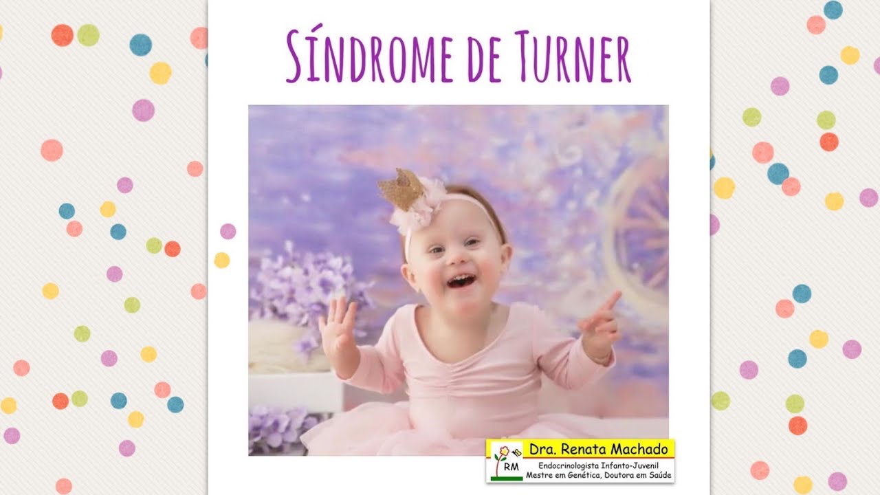 33 - Síndrome de Turner (Live do Instagram)